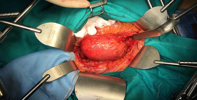 operazioni cardiochirurgia vascolare